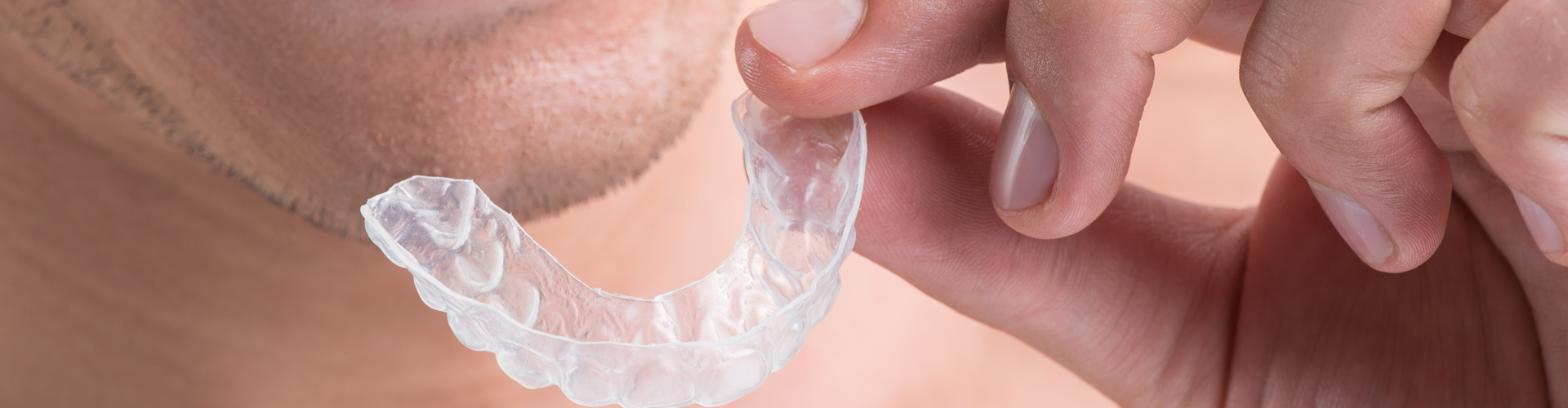 Invisalign